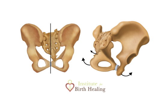 All the Effects of Birth on the Pelvis