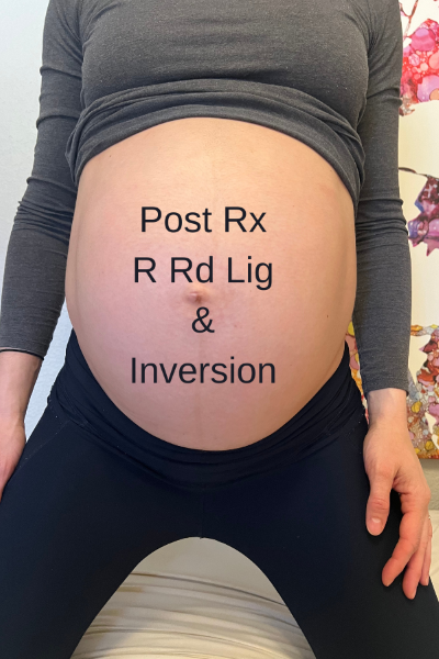 Post-Treatment-and-Inversion-Pregnancy-Case-Study